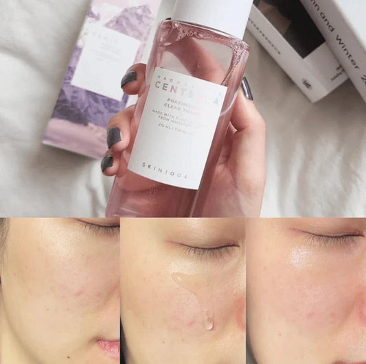 SKIN 1004 madagascar centella poreminzing clear tonner