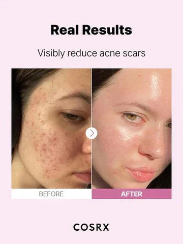 COSRX Niacinamide 15 Serum