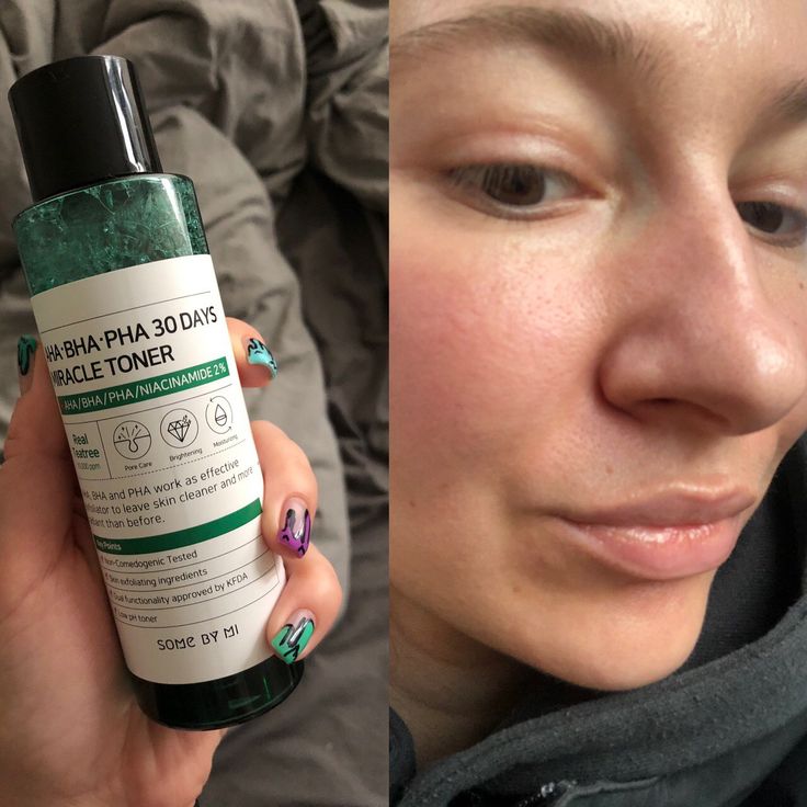 Some By Mi - AHA BHA PHA 30 Days Miracle Toner 150ml