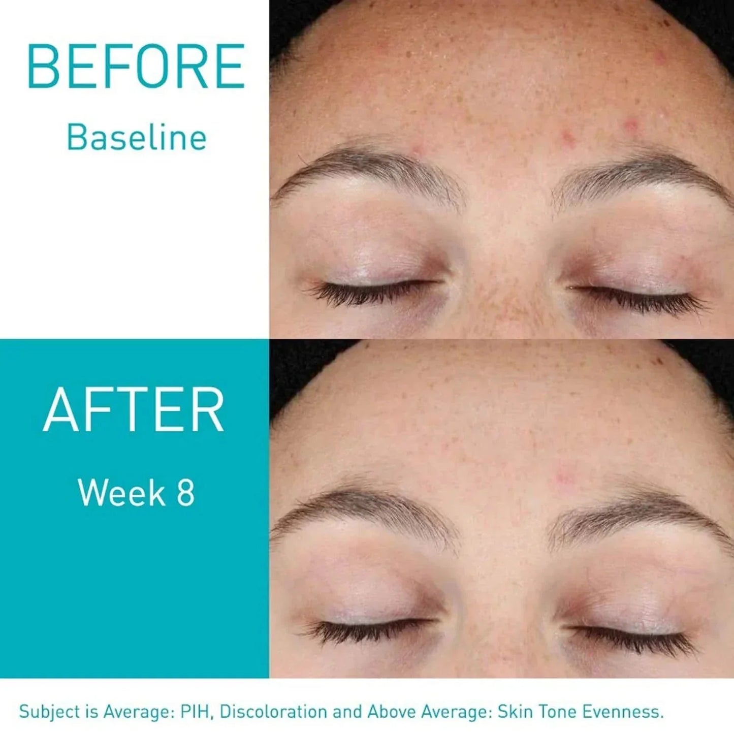 CeraVe Resurfacing Retinol Serum