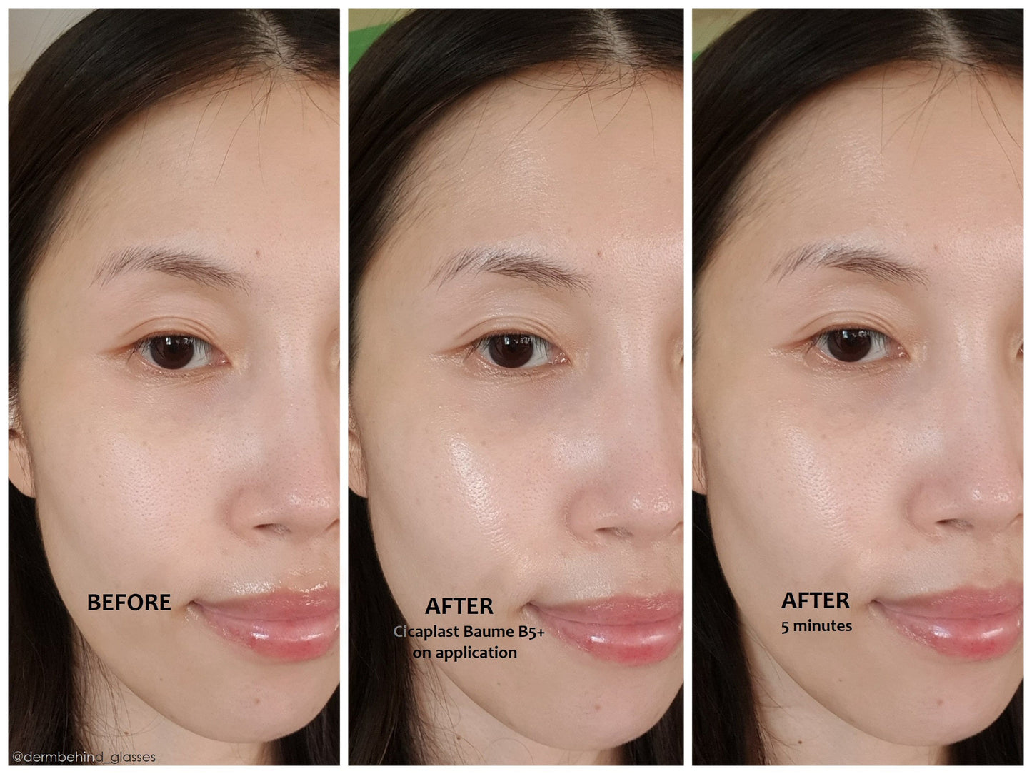 La Roche Posay - Cicaplast Baume B5+ Ultra-Repairing Soothing Balm 100Ml