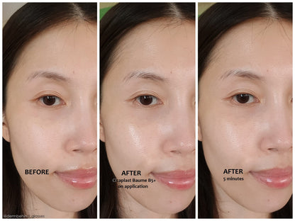 La Roche Posay - Cicaplast Baume B5+ Ultra-Repairing Soothing Balm 100Ml